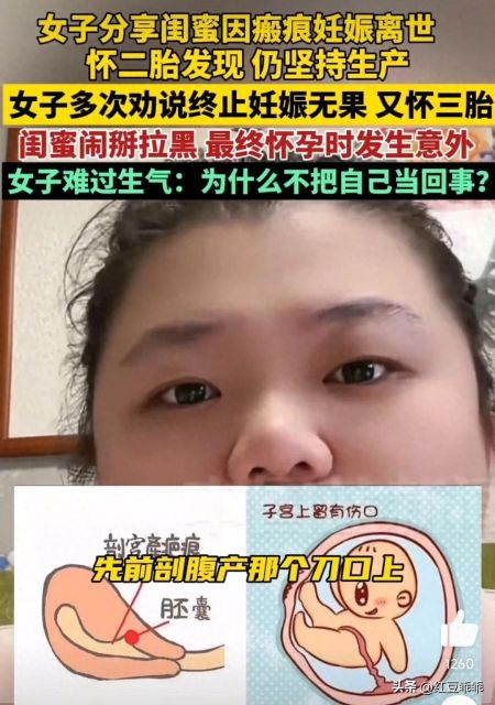 悲剧！女子瘢痕妊娠执意生三胎不幸离世，“万一这胎是个儿子呢”