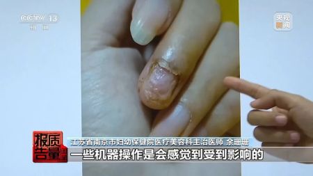 做美甲竟感染HPV，提醒：隐患多，别频繁做